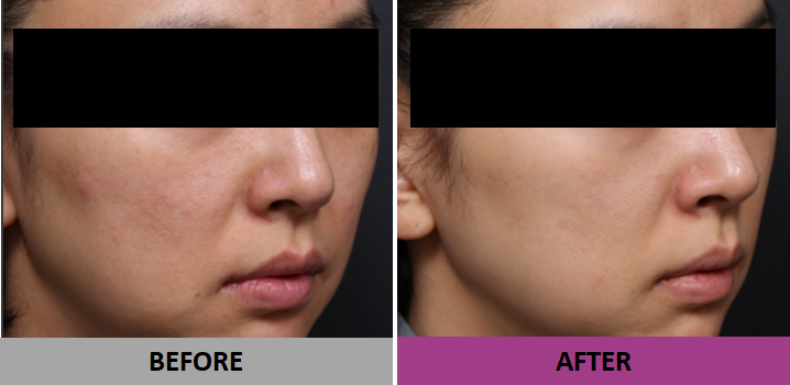  전후사진
