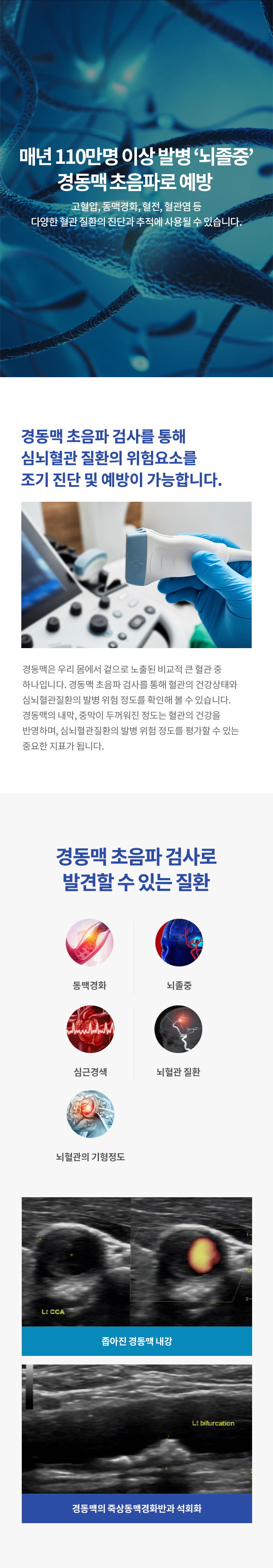 경동맥 초음파
