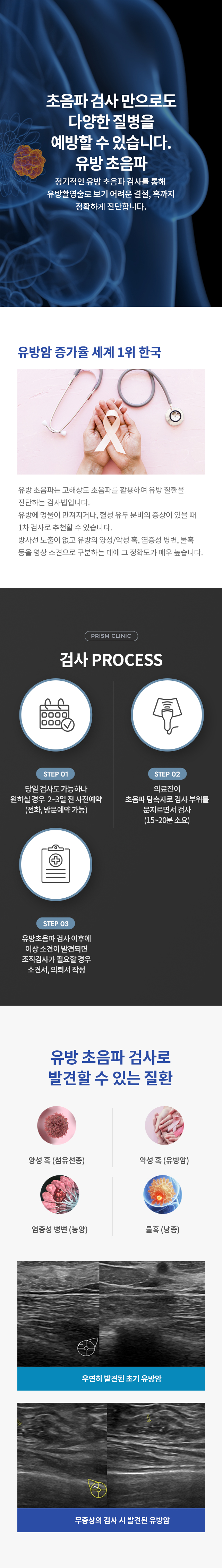 유방 초음파