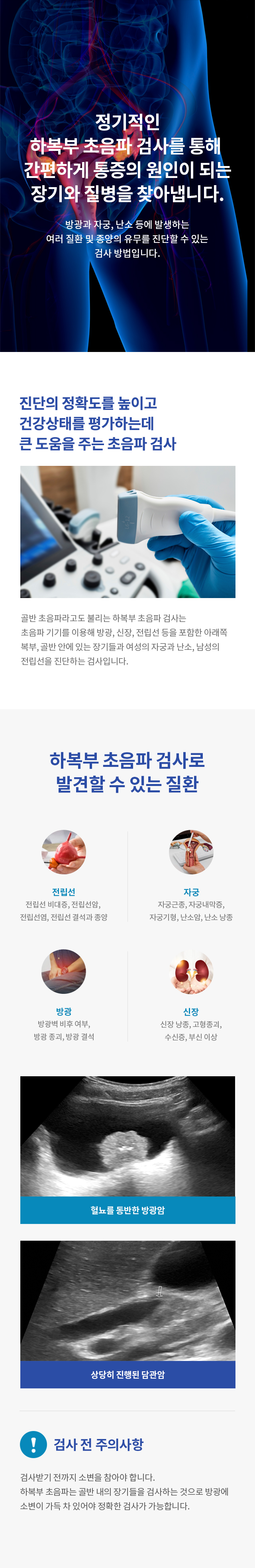 신장·방광·전립선 초음파