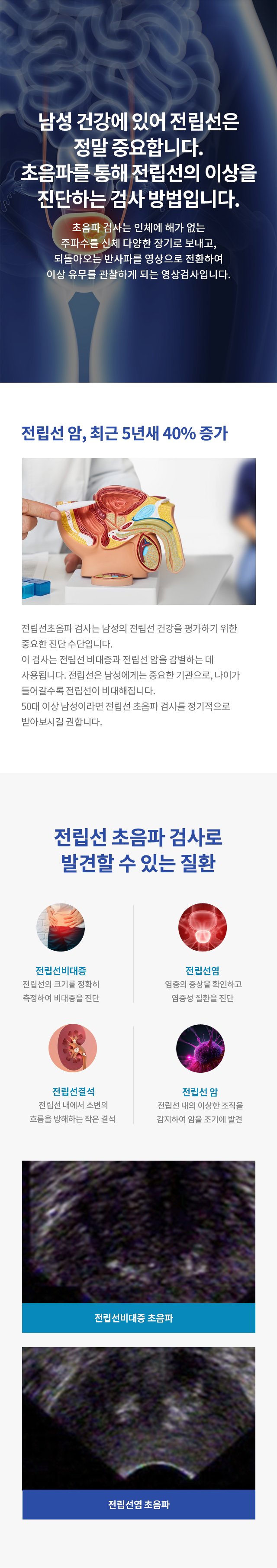 신장·방광·전립선 초음파