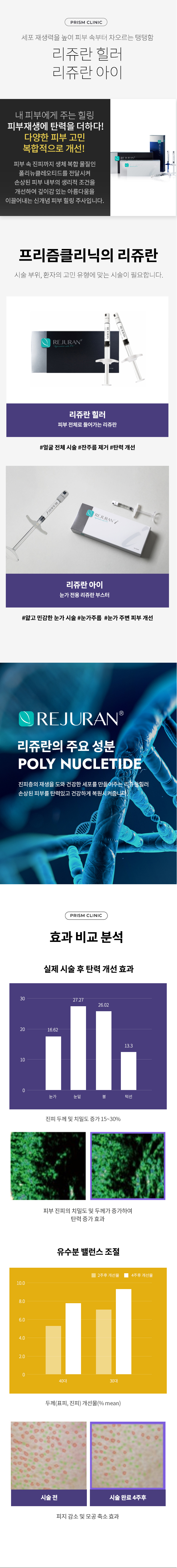 신개념 탄력 리프팅